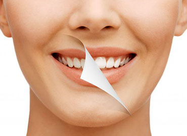 Smile Makeover Treatment in India