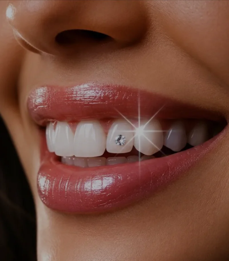 Tooth Jewellery -  Dentally
