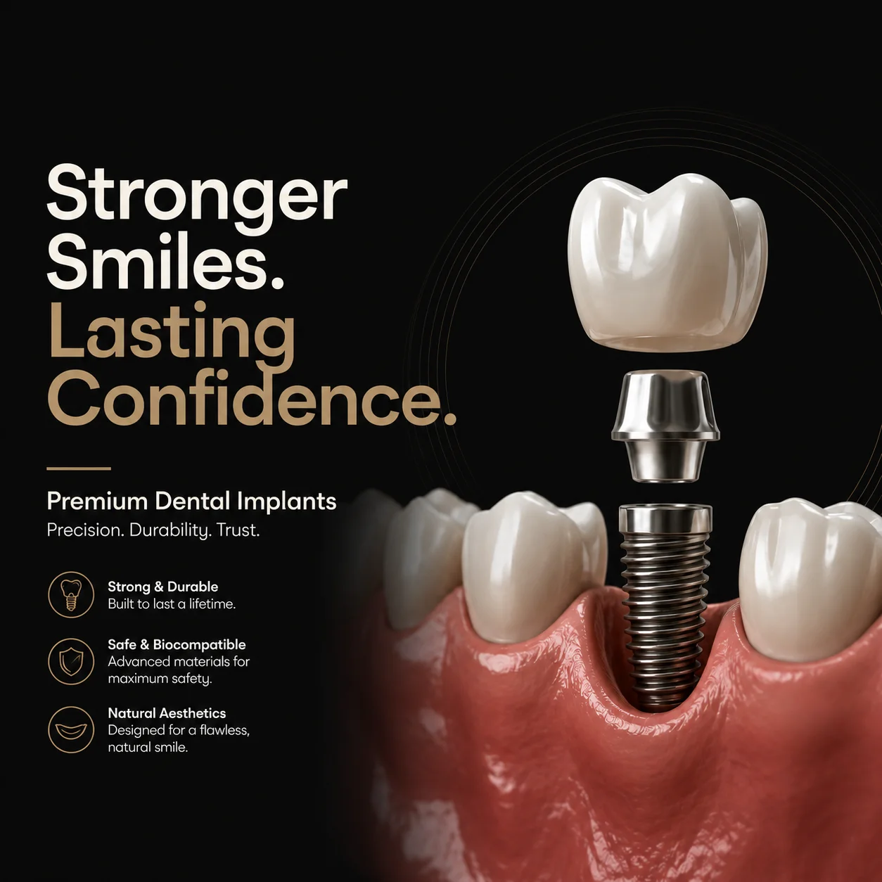 BASAL IMPLANTS -  Dentally