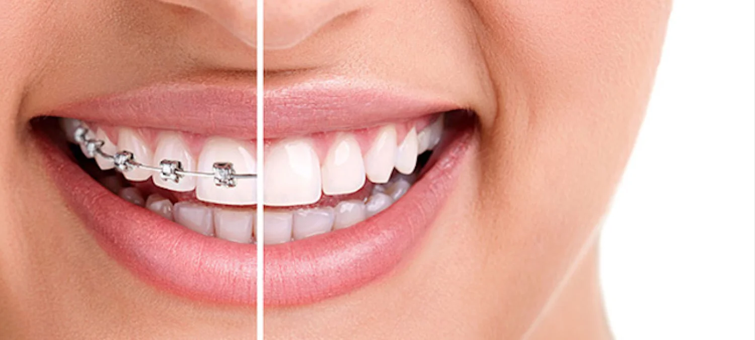 Banner - Dentally