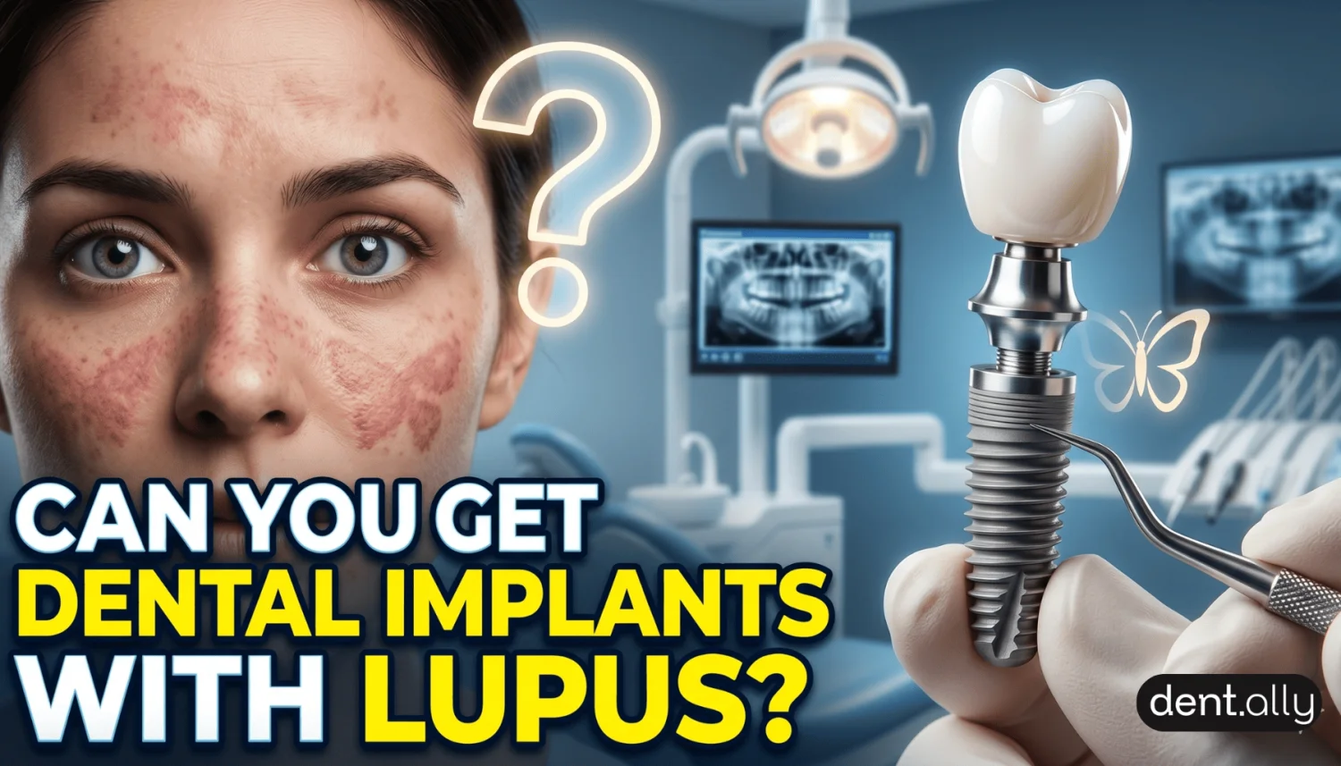 Can a Person With Lupus Get Dental Implants? -  Dentally