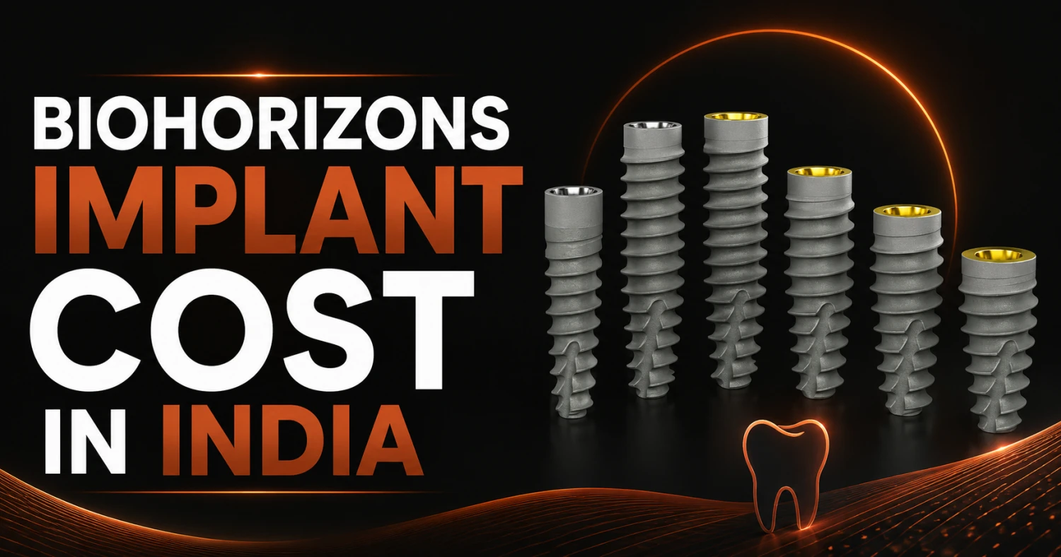 A Comprehensive Guide to BioHorizons Implant Cost in India