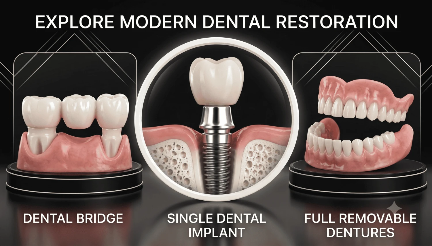 Dental Implants Compared to Other Alternatives