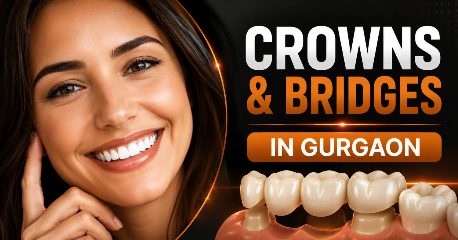 Dental Crowns & Bridges in Gurgaon