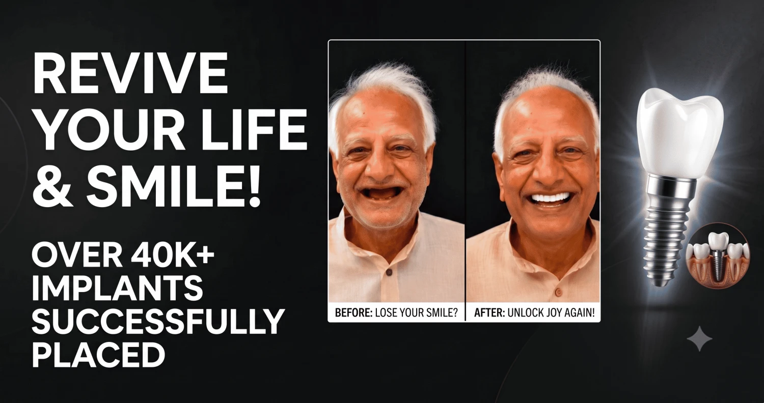 dental implants results