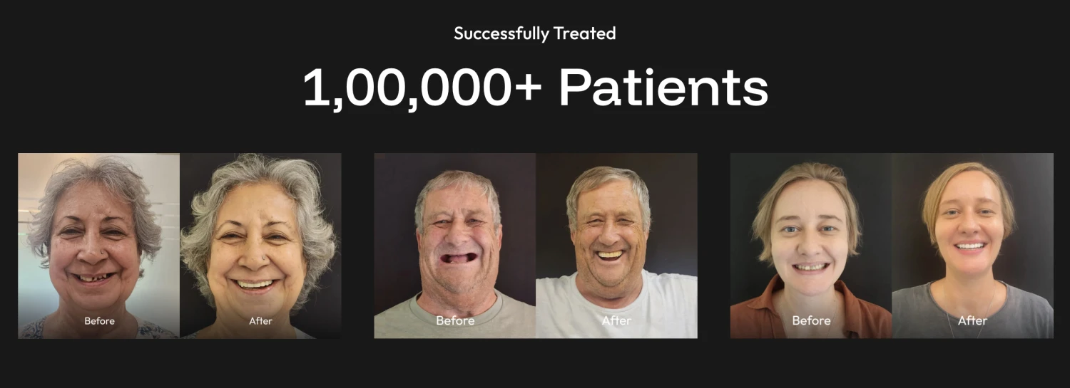 dental implants before after
