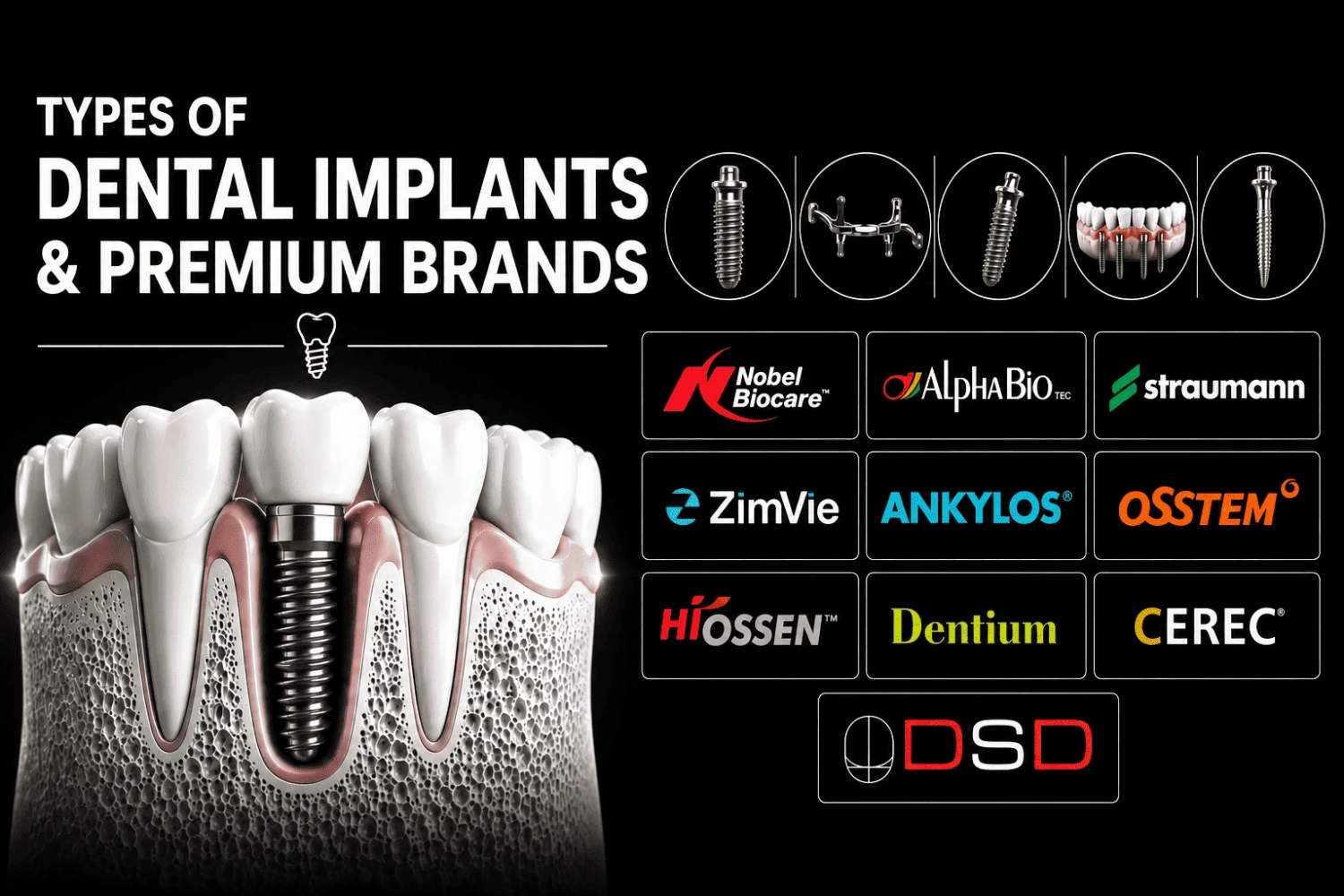 Types of Dental Implants and Premium Brands