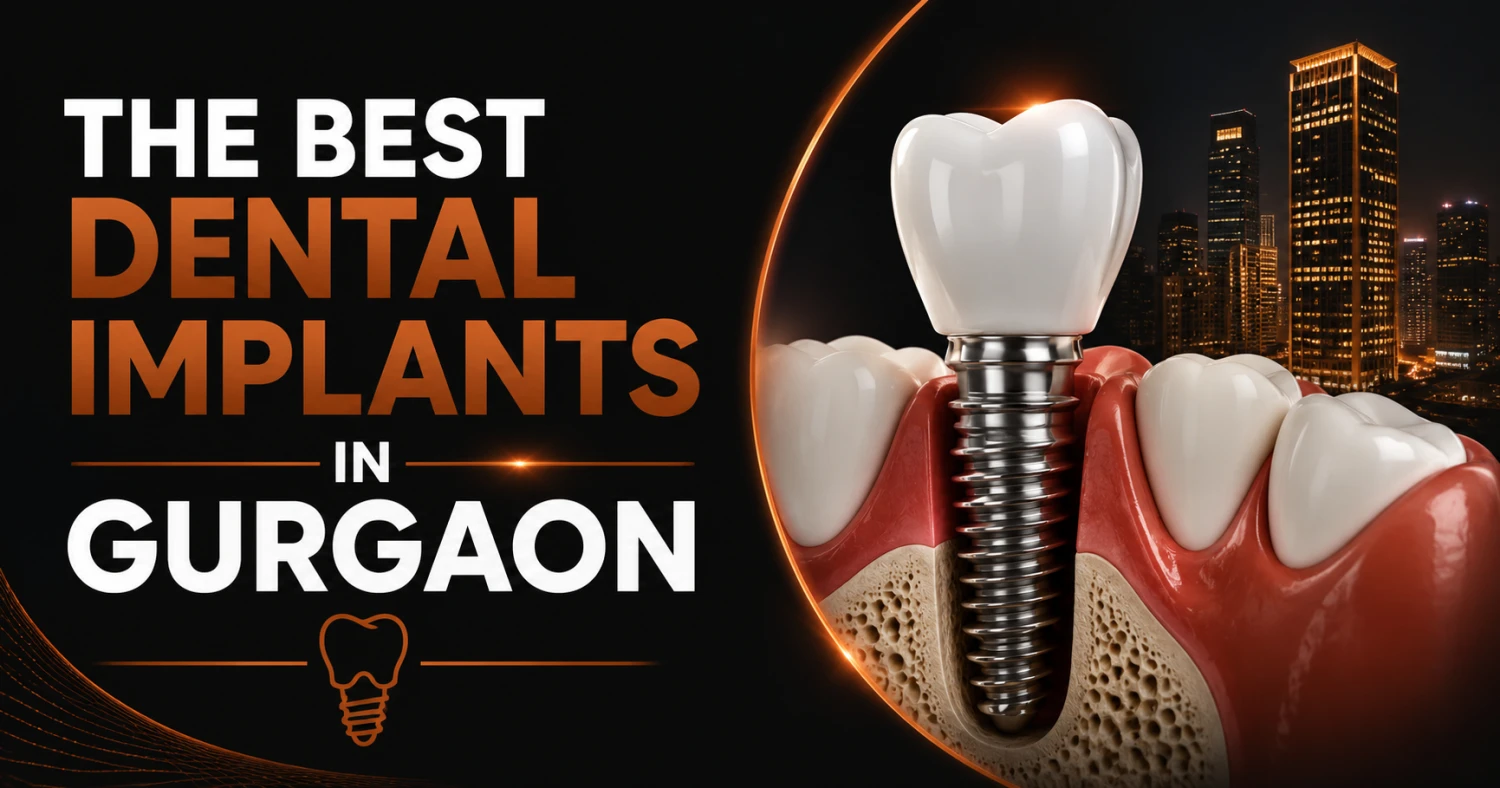 best dental implants in Gurgaon