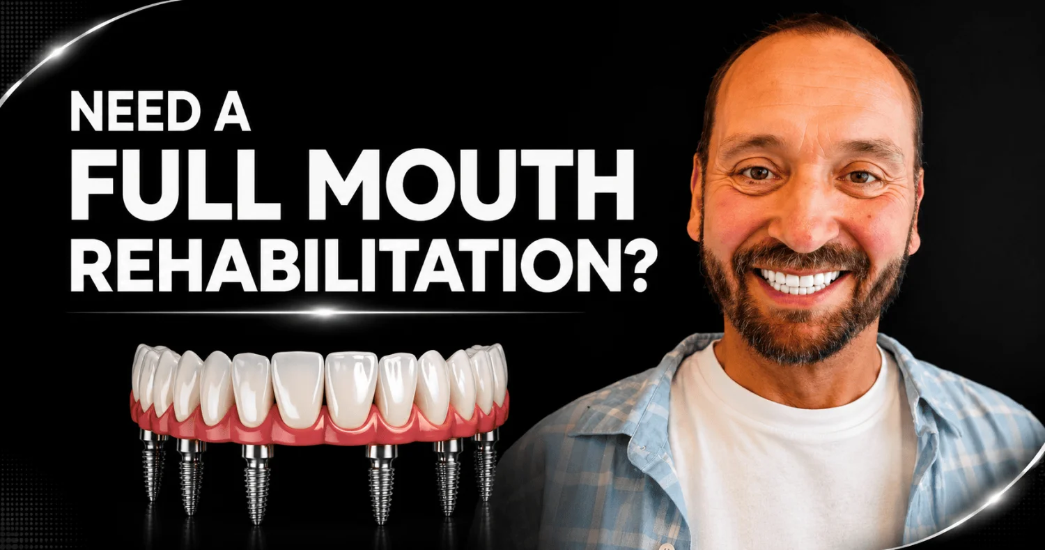 How Do I Know If I Need a Full Mouth Rehabilitation? A Comprehensive Clinical Guide -  Dentally