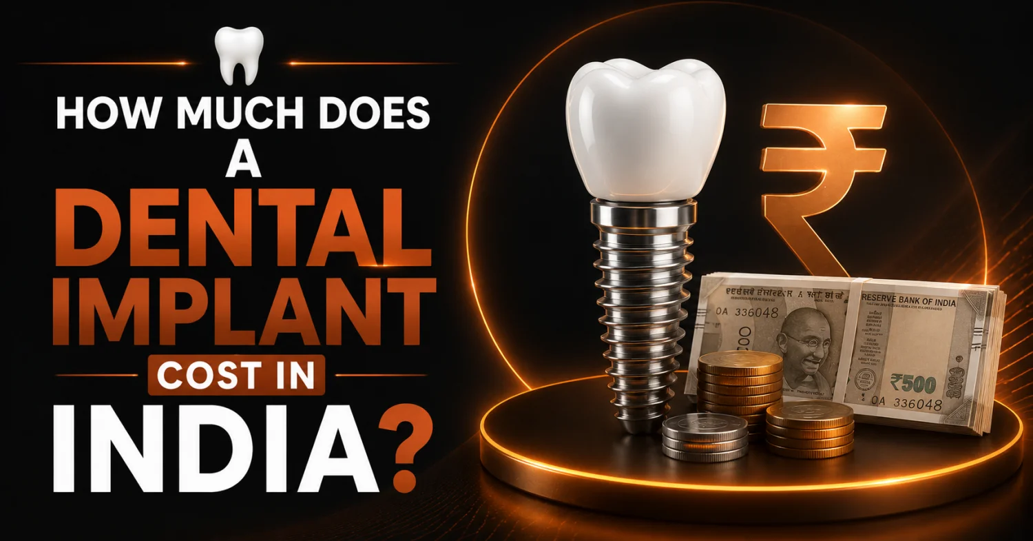 🦷 How Much Does a Dental Implant Cost in India? -  Dentally