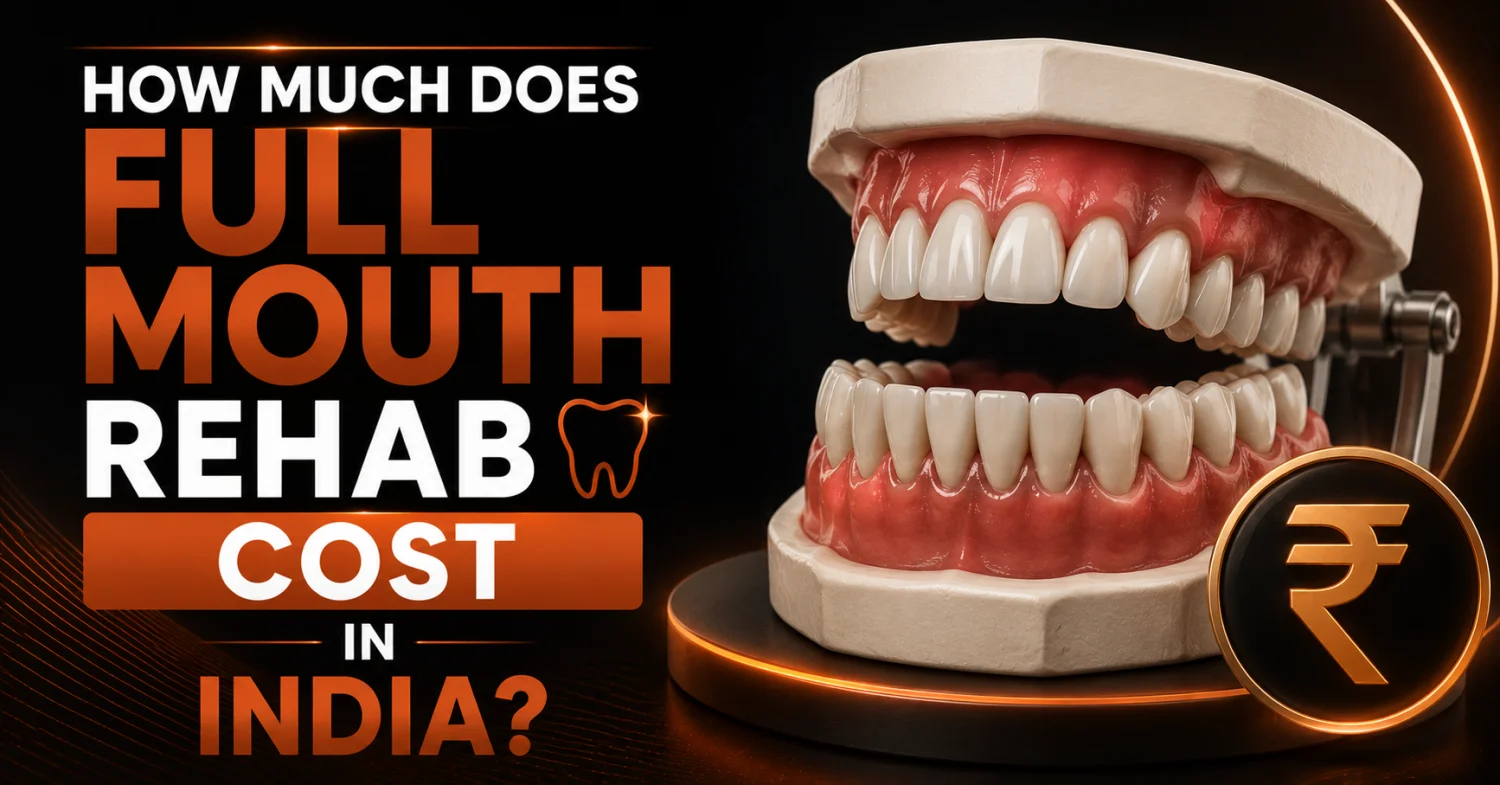 How much does full mouth rehab cost in India? -  Dentally