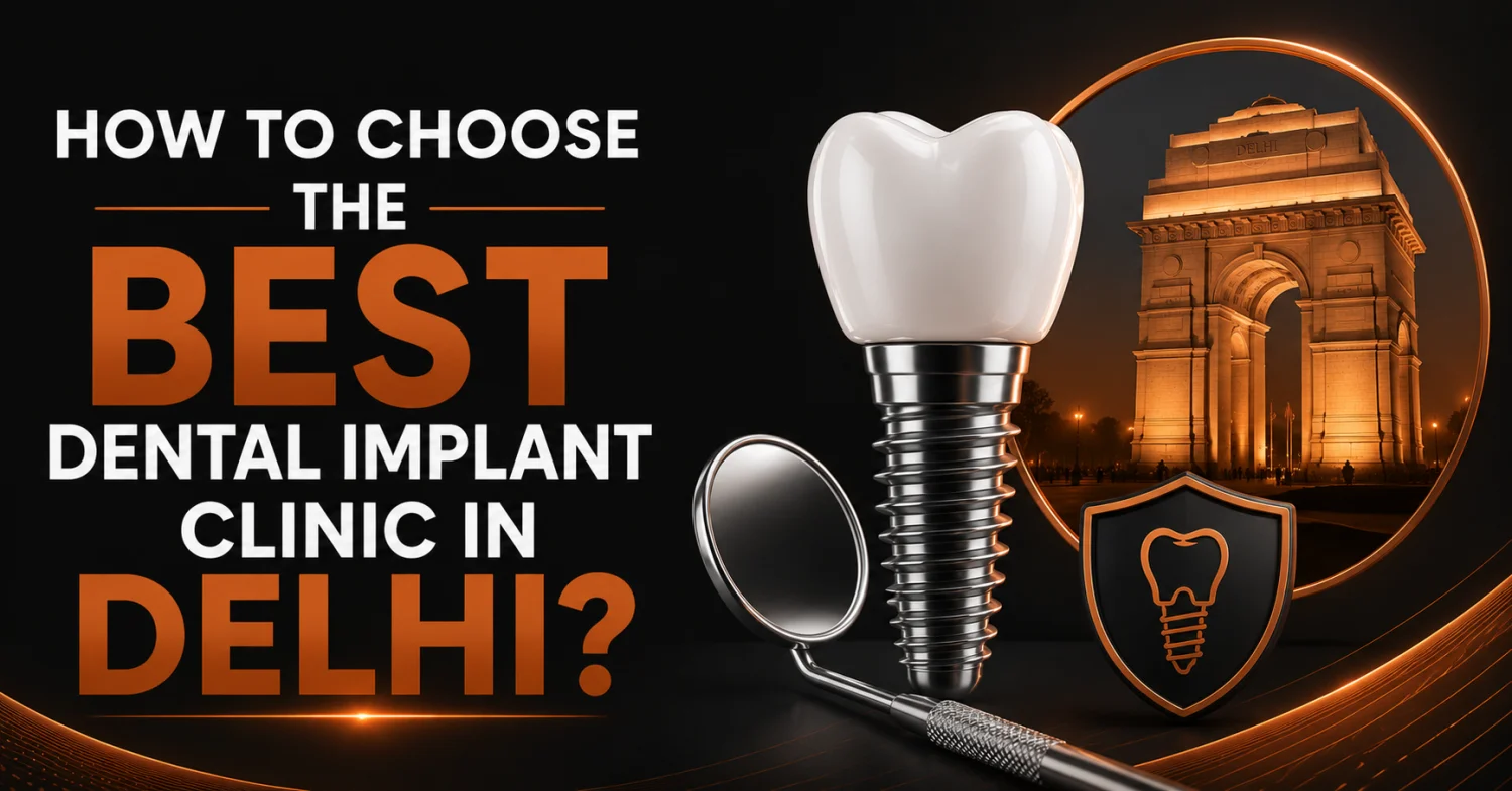 How To Choose the Best Dental Implant Clinic in Delhi? -  Dentally