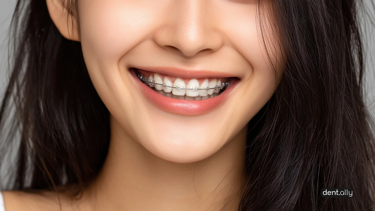 Will Braces Change My Face Shape? The Truth About Orthodontics and Facial Symmetry -  Dentally