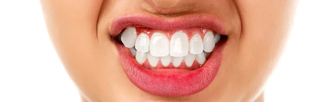 Bruxism Treatment and Diagnosis -  Dentally