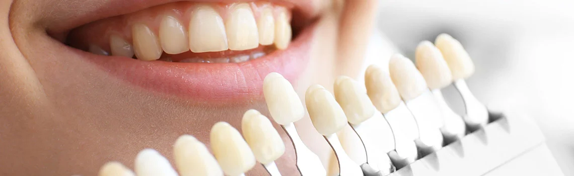 SAFEST, NON-TOXIC AND CHEMICAL FREE FILLINGS AT DENTALLY , Best Fillings for Teeth in Delhi -  Dentally