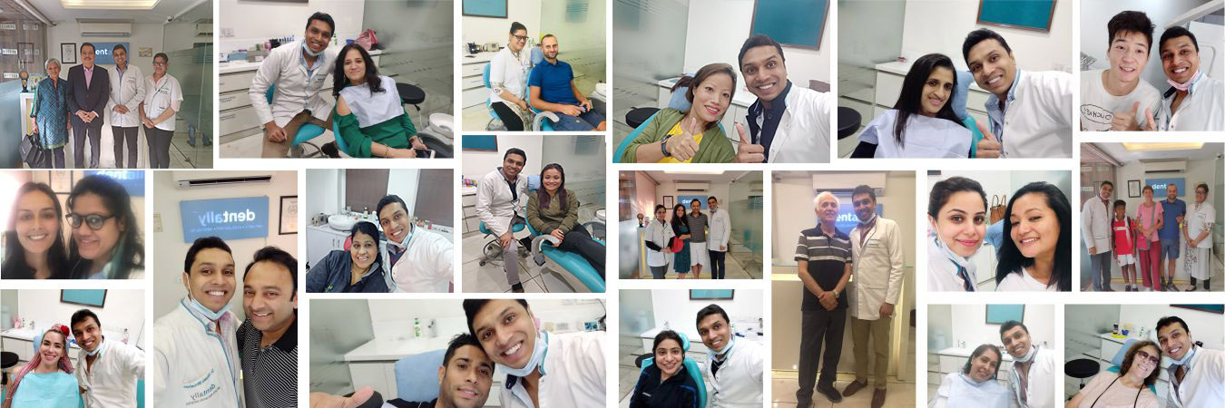 dentalcrowntreatmentdelhismilegallery