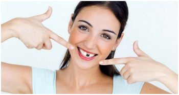 cost of dental implants in south delhi