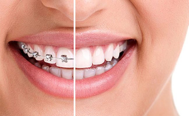 dental clinic delhi