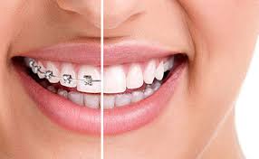 dental implants clinic