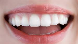dental implants delhi