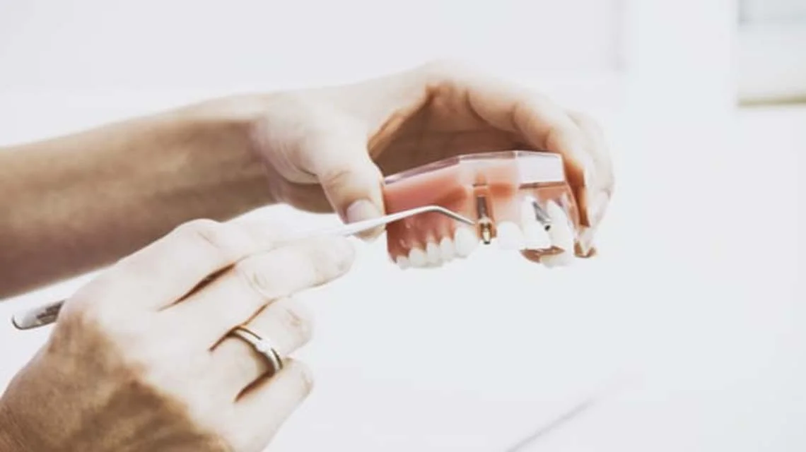 Why Dental Implants Are the Best Long-Term Solution for Missing Teeth in India (2026 Complete Guide) -  Dentally