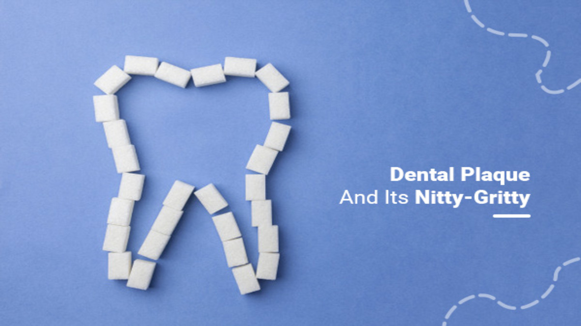 Dental-Plaque-And-Its-Nitty-Gritty