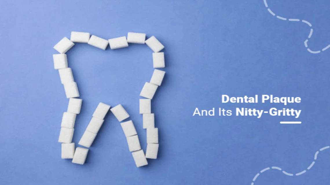 Dental Plaque And Its Nitty-Gritty -  Dentally