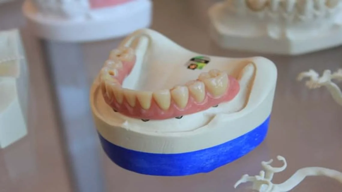 Which Dental Veneer Should You Choose? -  Dentally
