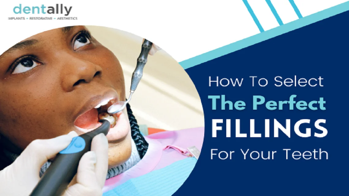How To Select The Perfect Fillings For Your Teeth? -  Dentally