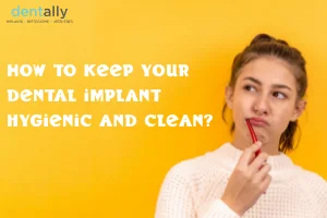 How to keep your dental implant hygienic and clean? -  Dentally