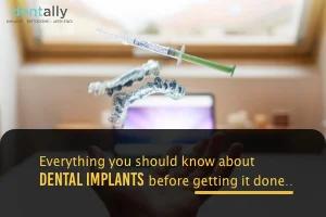Everything you should know about dental implants before getting it done -  Dentally