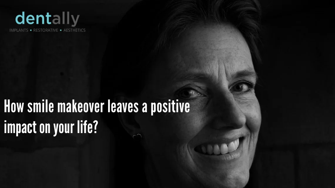 How Smile Makeover Leaves A Positive Impact On Your Life? -  Dentally