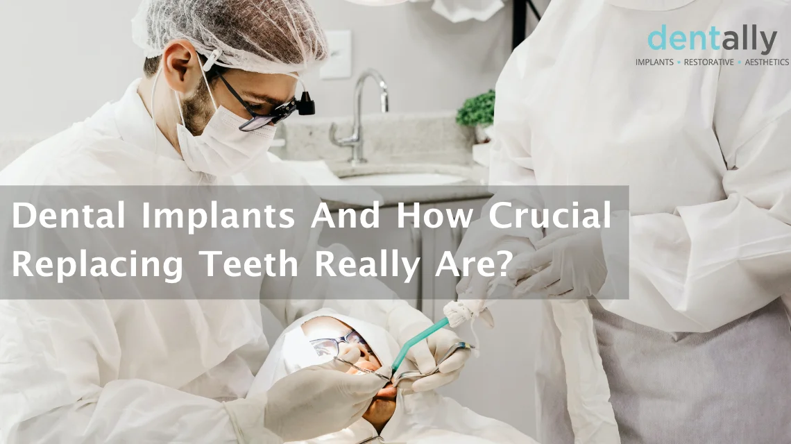 Dental Implants And How Crucial Replacing Teeth Really Are? -  Dentally