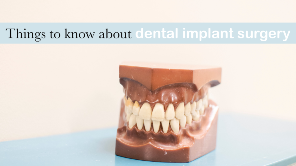 Things To Know About Dental Implant Surgery - Dent Ally