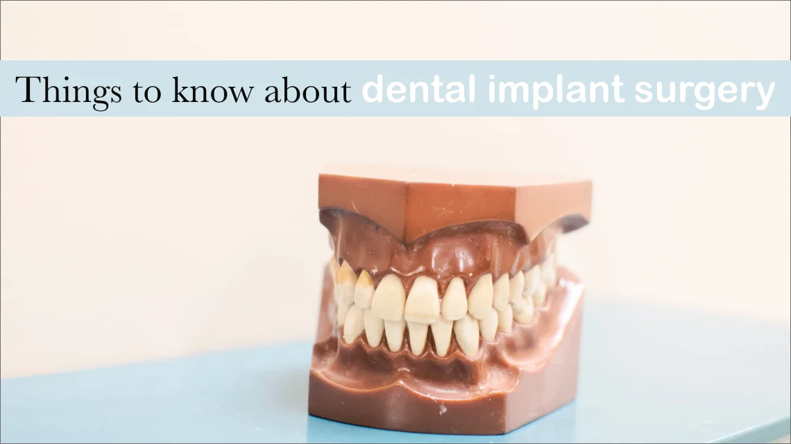 Things To Know About Dental Implant Surgery -  Dentally