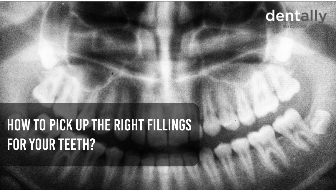 How To Pick Up The Right Fillings For Your Teeth? -  Dentally