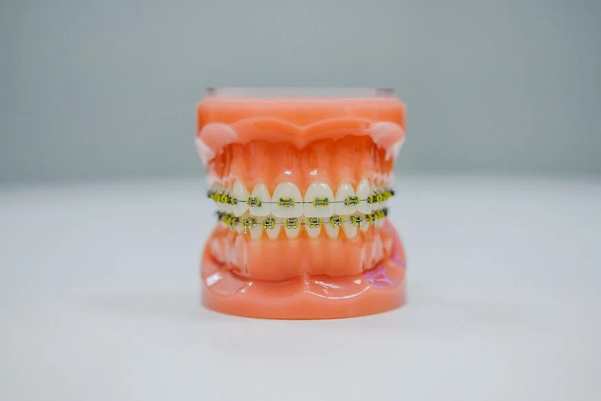 Night Guards To Protect Gums And Teeth -  Dentally