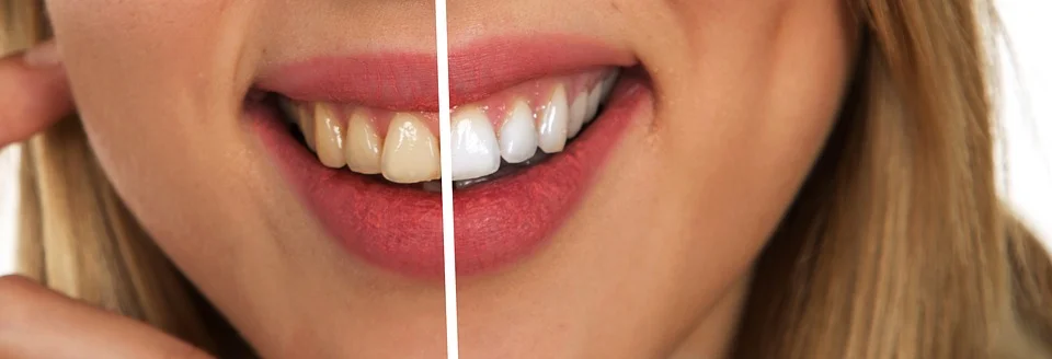All You Need To Know About Visiting The Dentist When You're Pregnant -  Dentally