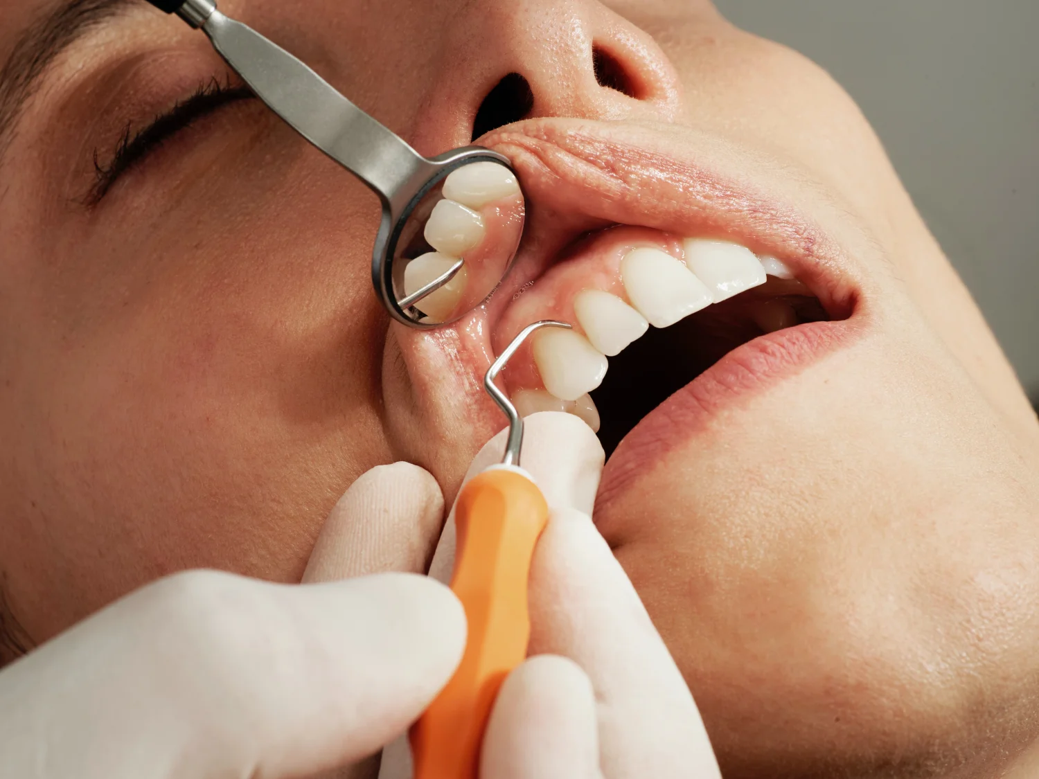 When Is the Best Time for a Dental Implant? -  Dentally
