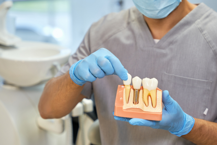 Pros and Cons of Dental Implants: Making Informed Choices for Your Smile