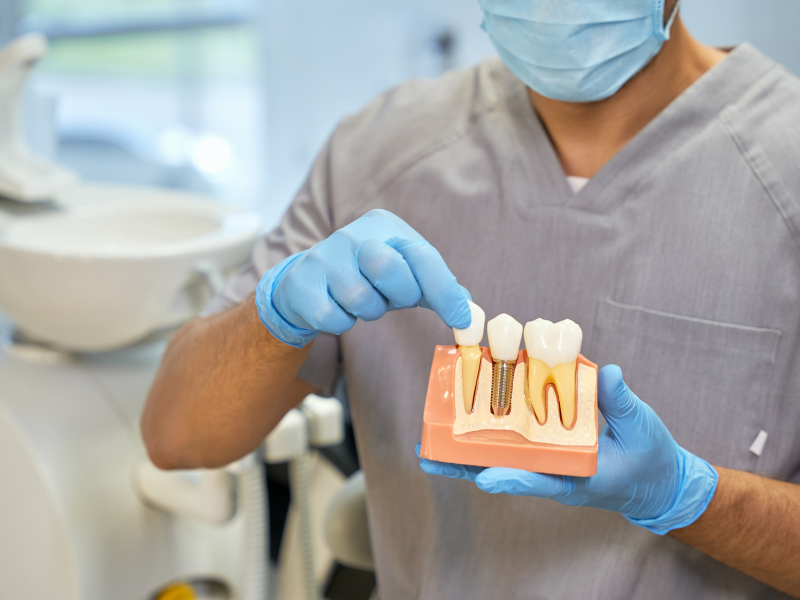 Pros and Cons of Dental Implants: Making Informed Choices for Your Smile