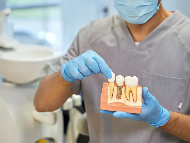 Pros and Cons of Dental Implants: Making Informed Choices for Your Smile with Dentally.in -  Dentally