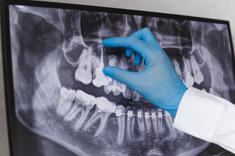 Advancements in Dental X-Rays Safeguarding Dental Health in India with Improved Technology