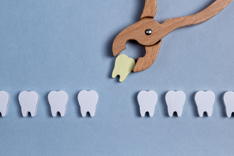 Understanding Tooth Loss: Causes, Impact, and Modern Solutions