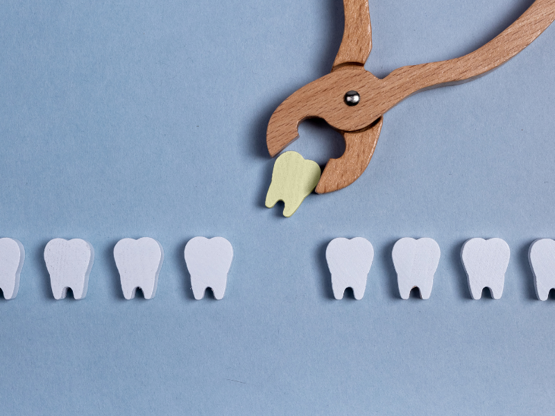 Understanding Tooth Loss: Causes, Impact, and Modern Solutions