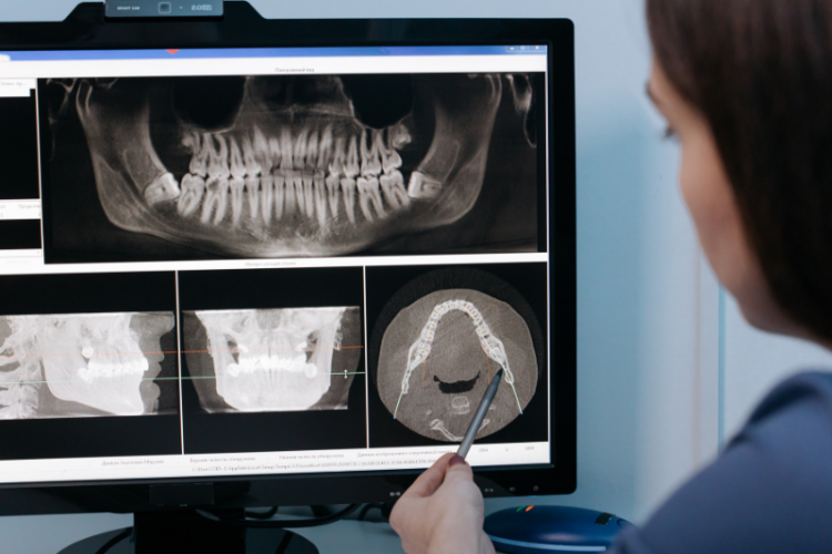Innovations in Dental Care Unveiling the Impact of Modern Technologies