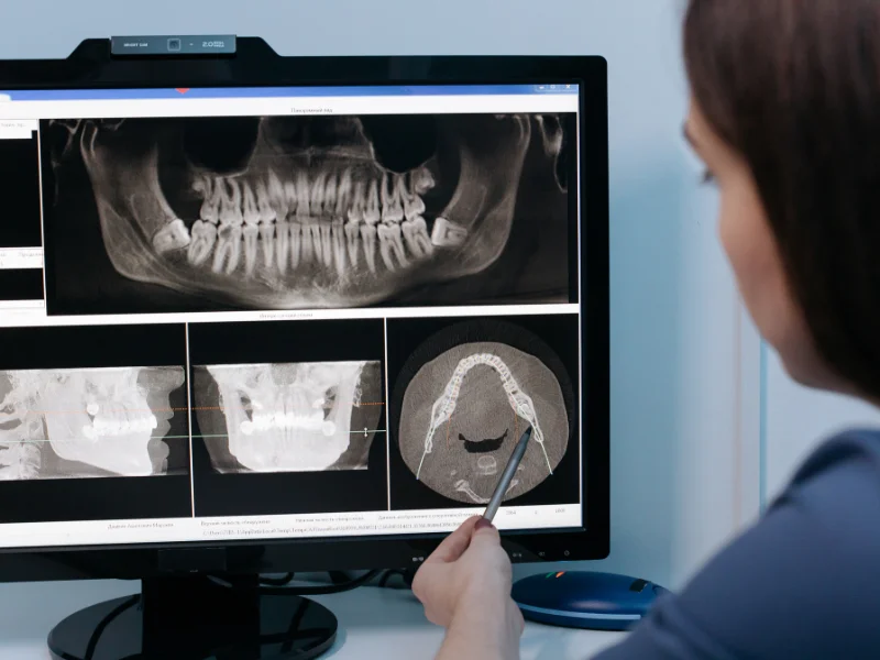 Innovations in Dental Care: Unveiling the Impact of Modern Technologies -  Dentally