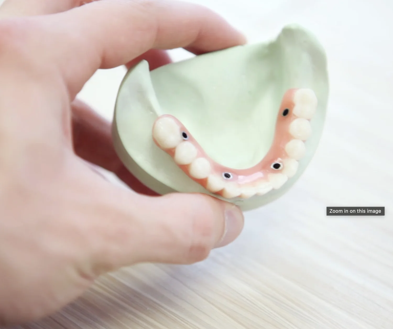 Can a dental implant be done in one day? -  Dentally