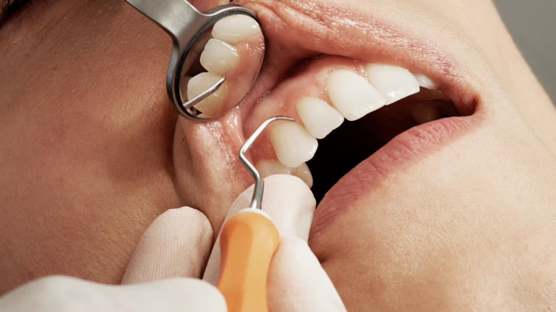 How long does a dental implant take to finish?