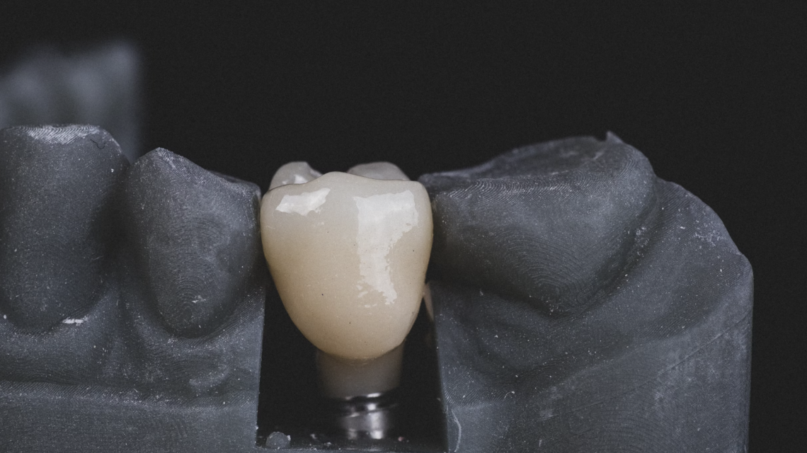 How painful is getting a dental implant?
